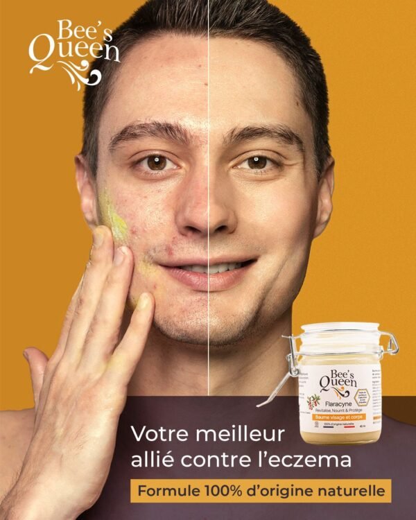 FLARACYNE BAUME Cicatrisant, Régénérant et Apaisant 100% d’origine Naturelle COSMOS – Image 4